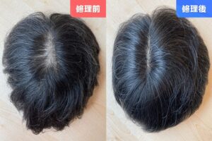 カツラ修理前修理後20251201